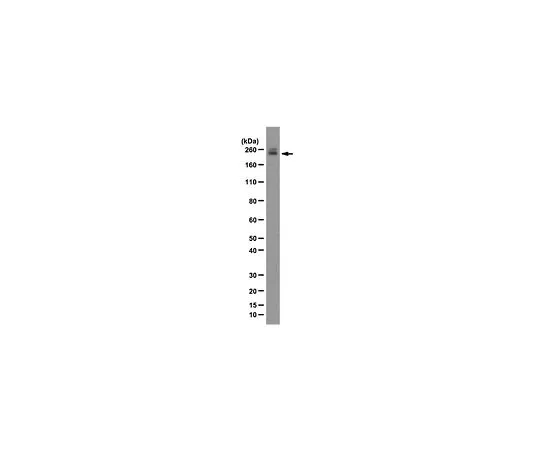 62-8493-85　［Discontinued］Anti-DscamL, clone DS1-96; 100 μg　MAB2602