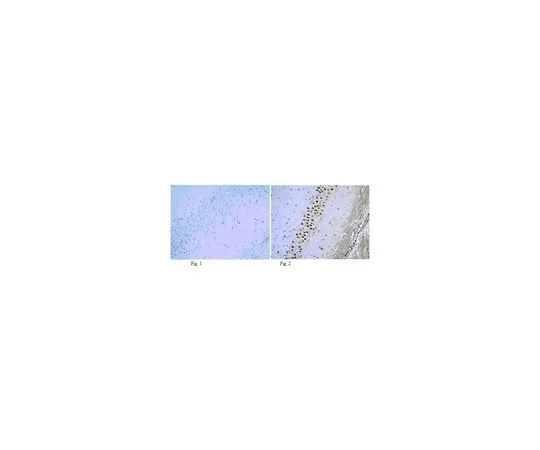 62-8465-67　［Discontinued］Anti-phospho-NR1 (Ser896); 100 μg　ABN88