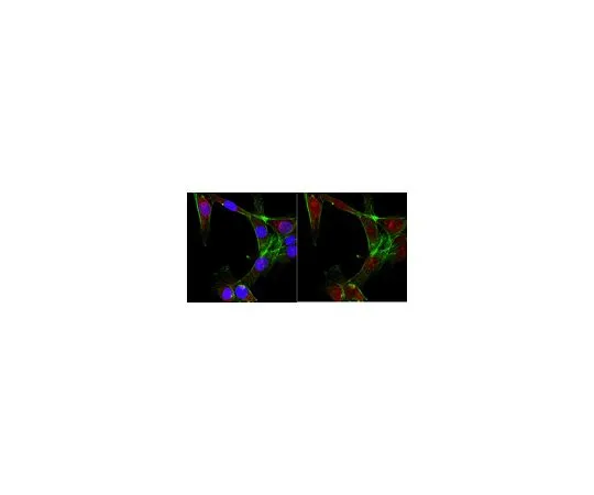 62-8474-05　［Discontinued］Anti-Glypican-1　ABT1385