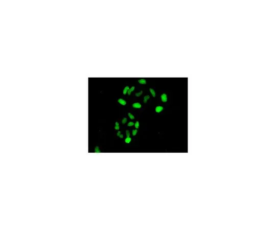 62-8506-81　［Discontinued］Anti-ERCC1, clone EPR7062, Rabbit Monoclonal　MABE608