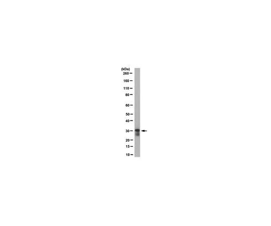 62-8518-88　［Discontinued］Anti-Potassium Channel KChIP, clone K55/82　MABN657