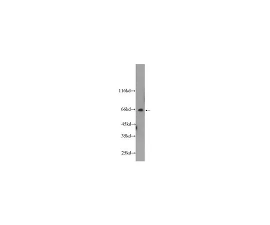 62-8457-51　［Discontinued］Anti-PRCC　ABC293