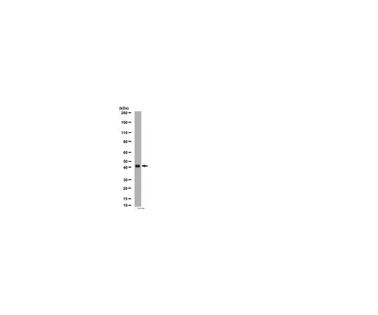 62-8452-33　［Discontinued］Anti-beta Arrestin 2; 100 μg　AB6022