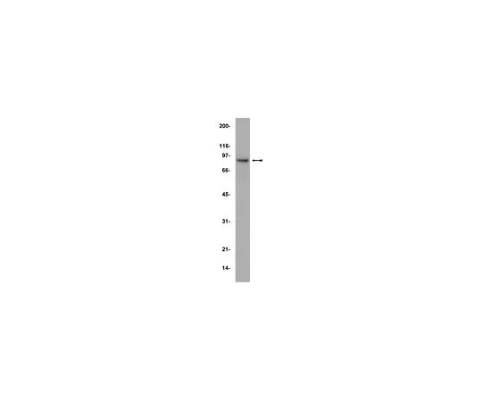 62-8382-33　［Discontinued］Anti-Rsk2/MAPKAP Kinase 1b; 100 μg　06-918