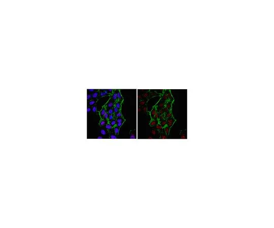 62-8389-97　［Discontinued］Anti-JMJD1B; 100 μg　09-816