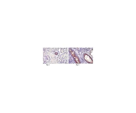 62-8472-50　［Discontinued］Anti-Inscuteable; 100 μg　ABT64