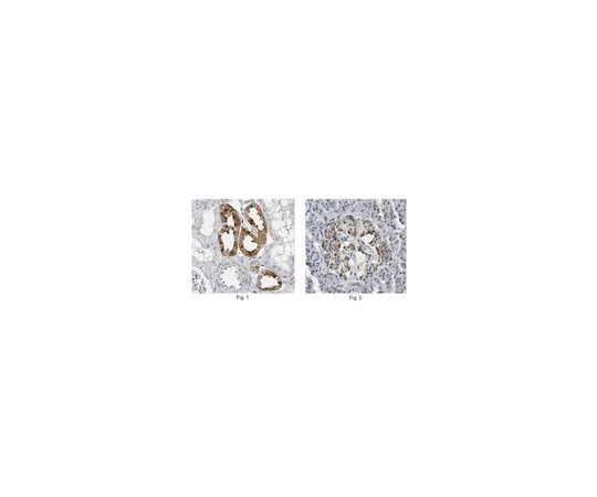 62-8470-54　［Discontinued］Anti-AHR　ABS522