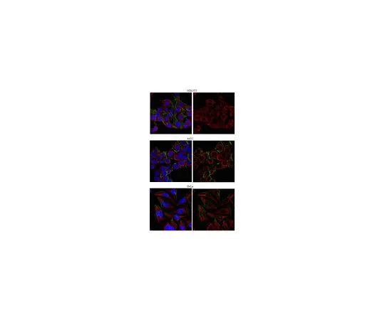 62-8459-93　［Discontinued］Anti-HDAC10; 100 μg　ABE16