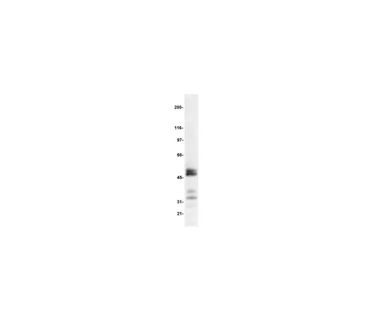 62-8371-46　［Discontinued］Anti-TCF-1, clone 7H3; 100 μg　05-510