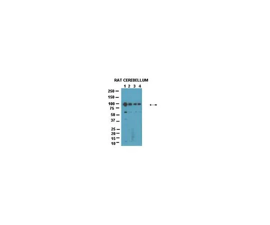 62-8446-41　［Discontinued］Anti-phospho GluR4 (S842); 50 μL　AB2212