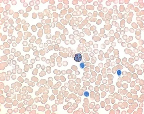61-0314-66　［Discontinued］LEUCOGNOST(R) POX Detection Of Leukocyte Peroxidase Activity 116303 12Units　1.16303.0002