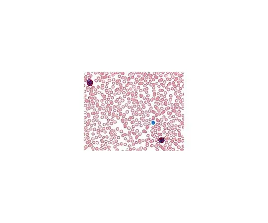 62-8535-61　［Discontinued］LEUCOGNOST(R) NASDCL Detection of naphthol AS-D chloroacetate esterase in granulocytes　1.16198.0001