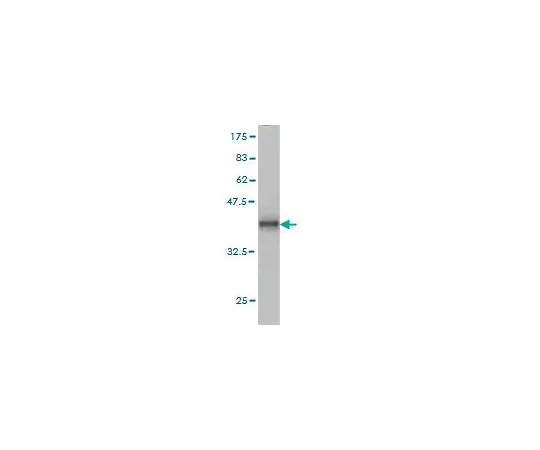 62-8533-79　［Discontinued］Anti-ADAM12 Mo*** mAb (1G3)　ST1600-100UG