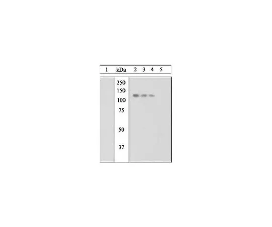 62-8425-21　［Discontinued］PhosphoDetect(TM) Anti-JAK1 (pTyr1022/1023) Rabbit pAb　420092-10T