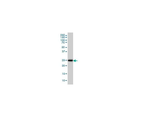 62-8478-90　［Discontinued］Anti-CD99 Mo*** mAb (3A10)　CB1050-100UG