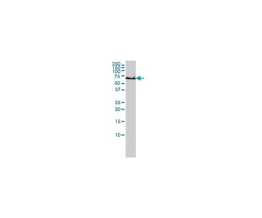 62-8481-32　［Discontinued］Anti-GCLC Mo*** mAb (3H1)　DR1045-100UG