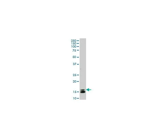 62-8481-50　［Discontinued］Anti-ID1 Mo*** mAb (1F7)　DR1098-100UG